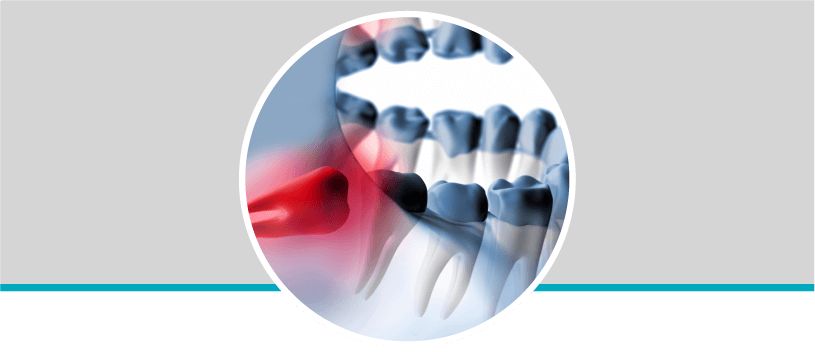 Valoración de cirugía oral y maxilofacial en Odontólogos La 73, Laureles, Medellín