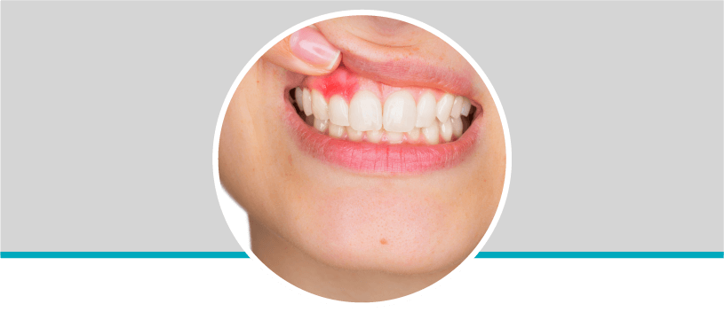 Valoración de periodoncia en Odontólogos La 73, Laureles, Medellín
