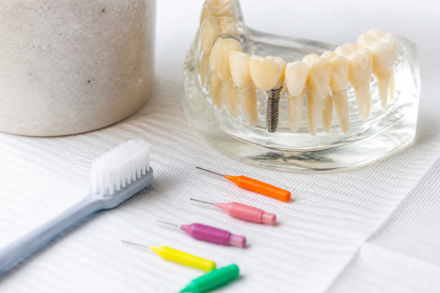 Cómo cuidar los implantes dentales después de colocarlos