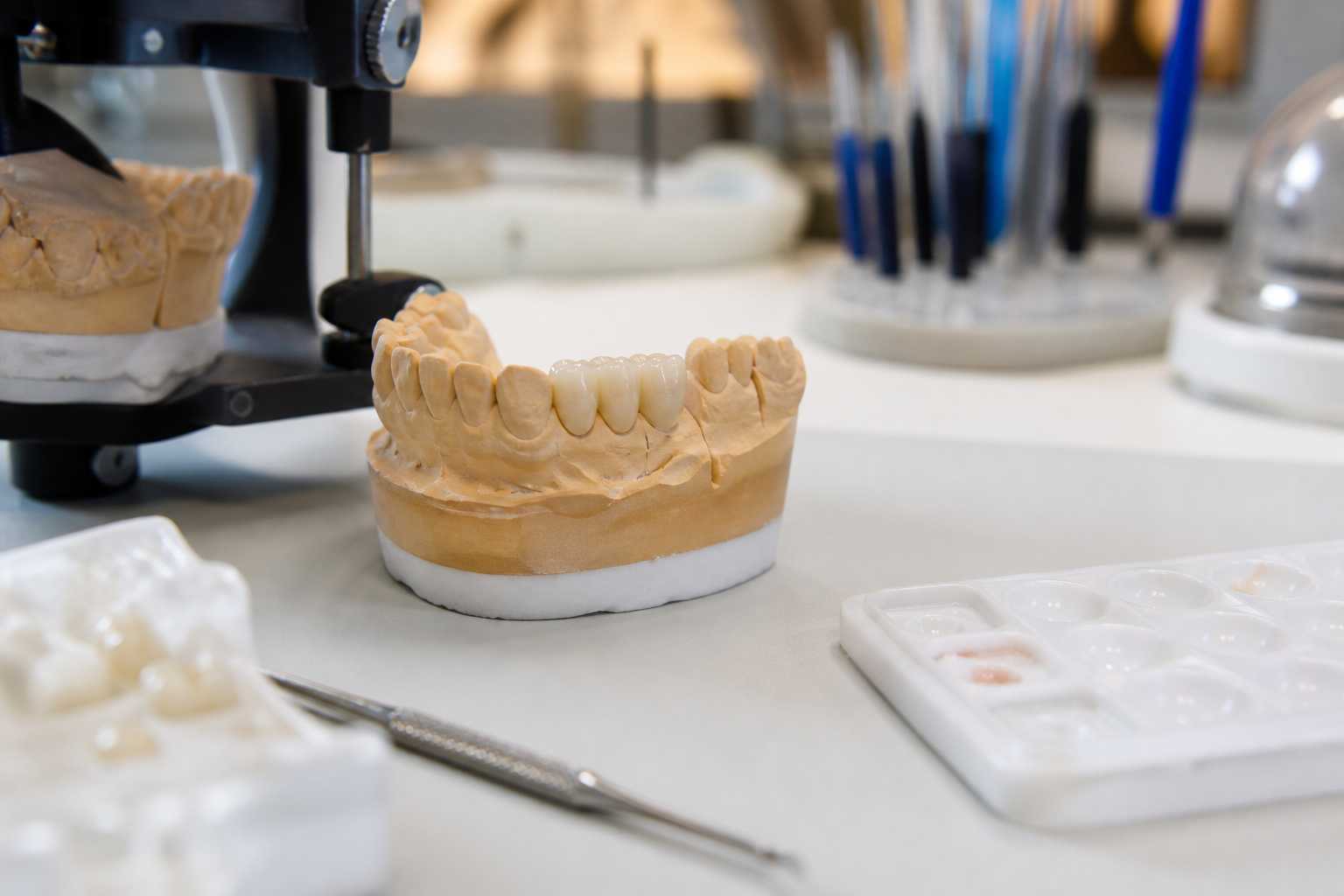 Qué hace diferente a una rehabilitación oral bien planificada
