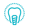 Implantes dentales